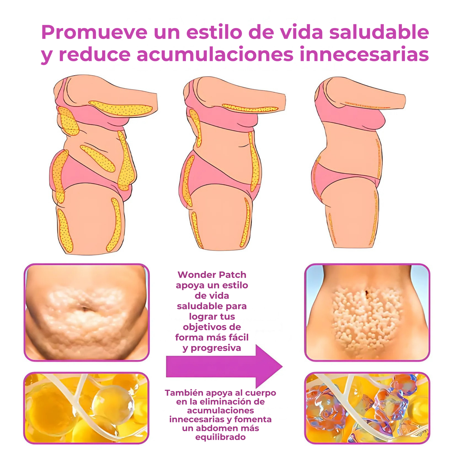 Pack 5 Slimming Patch - Wonder Patch™