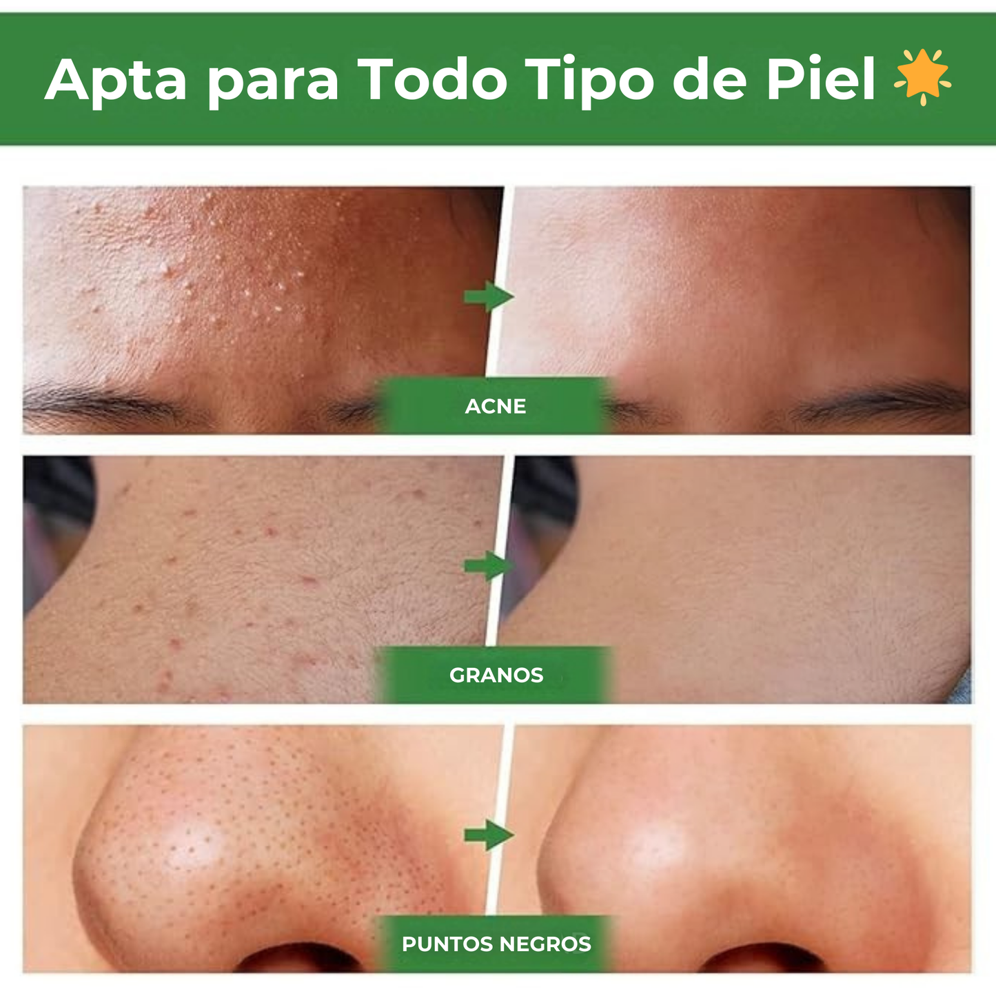 Mascarilla De Te Verde En Barra - GREEN™