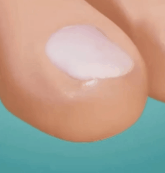 50 Parches Correctores Uñas – Mila Store
